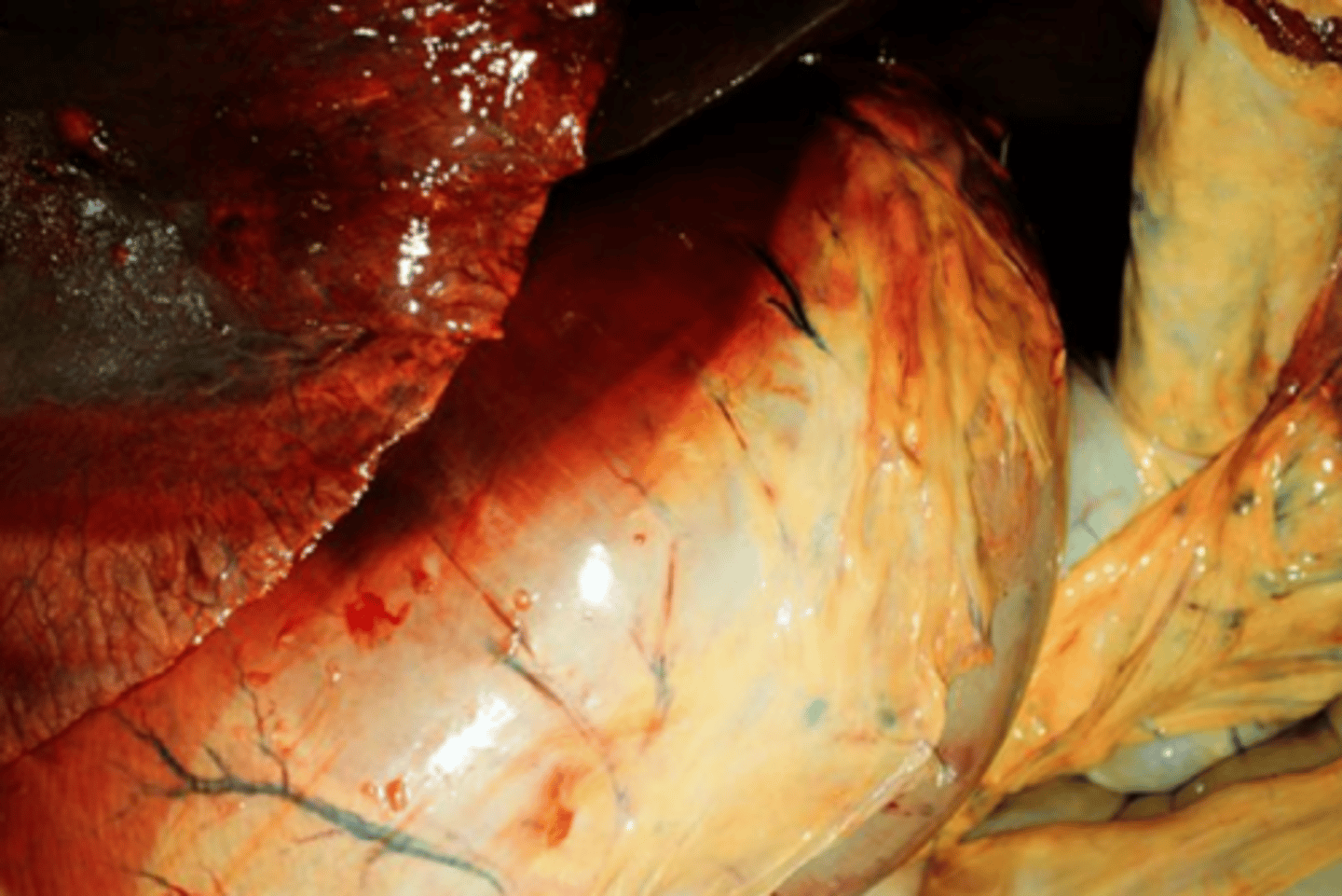 <p>What is causing the deep red pigment on the top of this organ?</p>