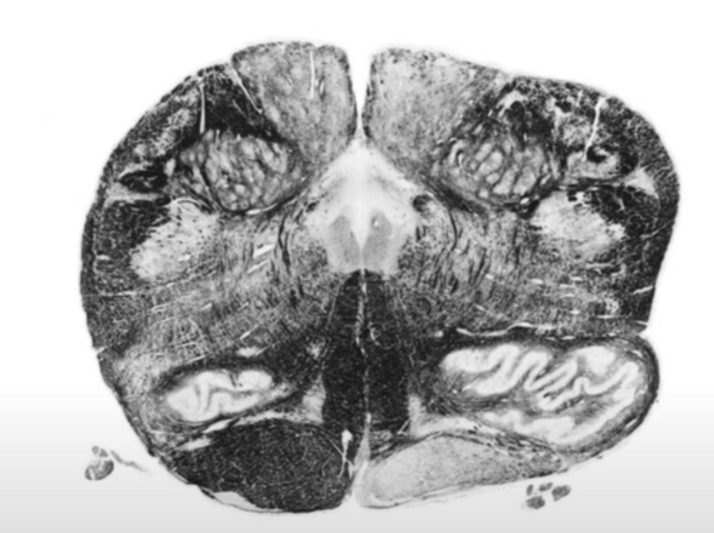 <p>ID the brainstem level</p>