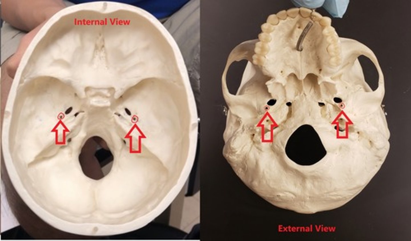 <p>smallest hole after the foramen ovale</p>