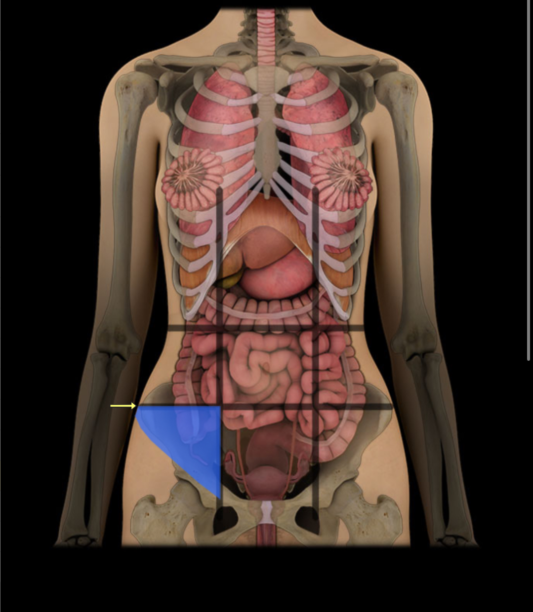 <p><span style="color: red;"><strong>Lower right near groin;</strong></span> <strong>contains intestines.</strong></p>