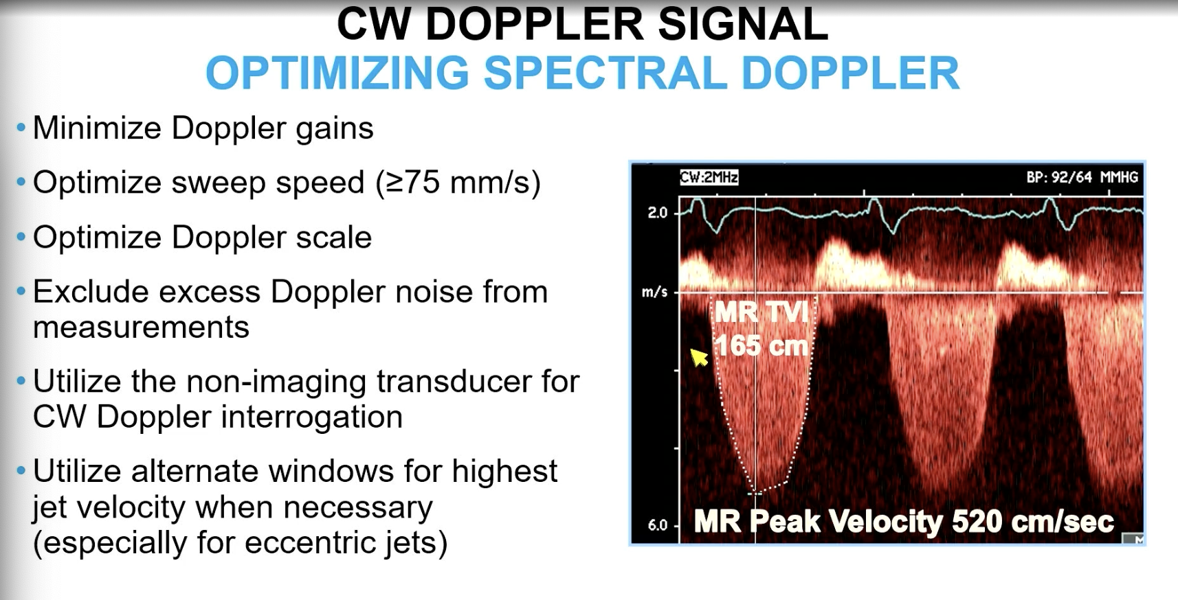<p>>/= 75 mm/s</p><p></p><p>FYI if eccentric jet, can get CW doppler in other views</p>