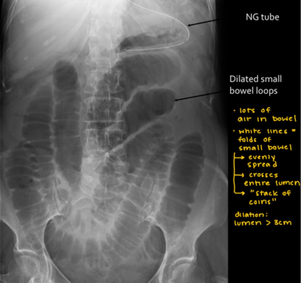knowt flashcard image