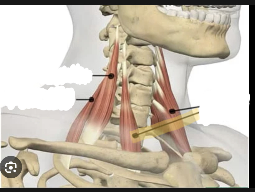 <p>Identify the highlighted muscle</p>