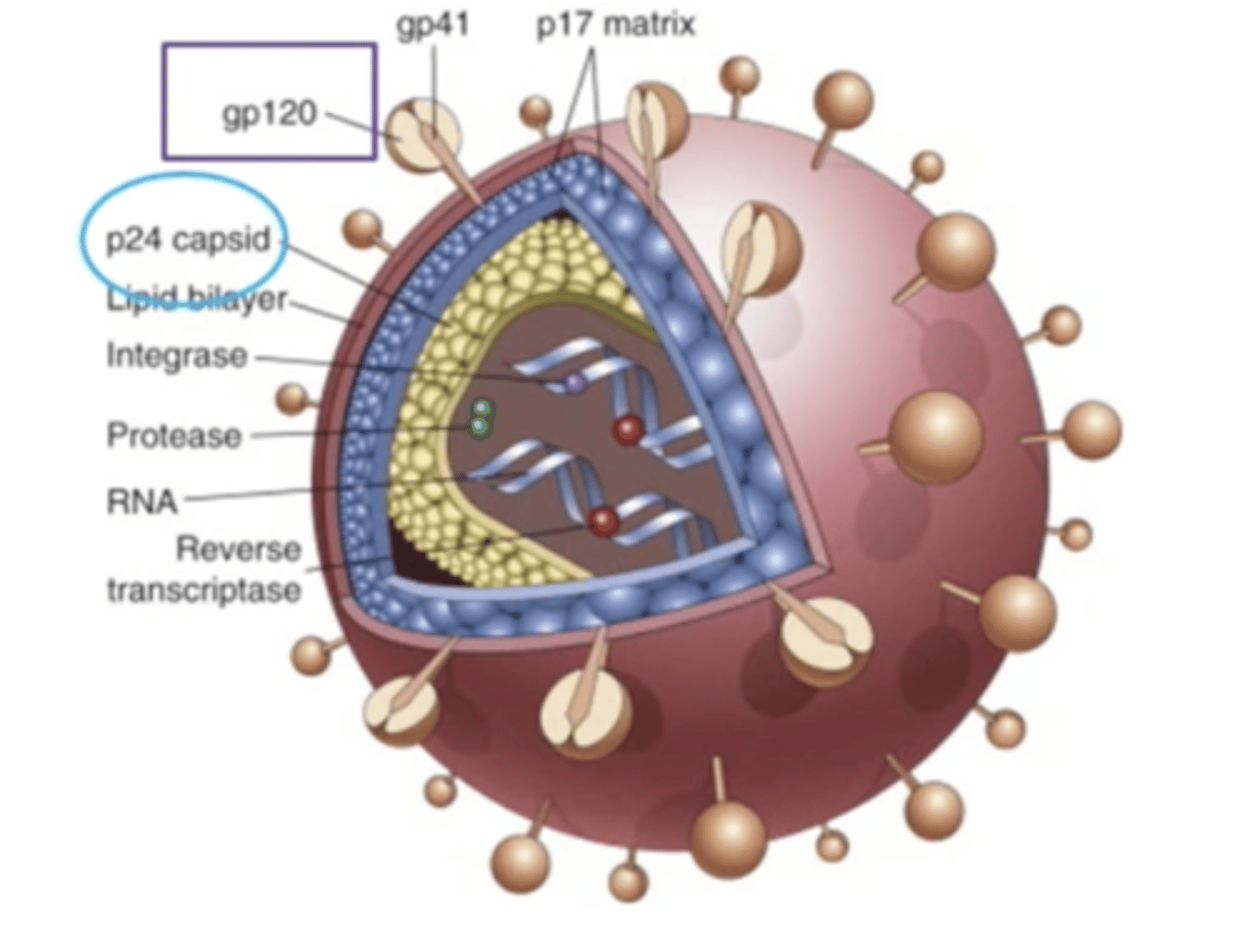 <p>acquired immune deficiency syndrome. Caused by a viral infection which is HIV. Depletion of CD4+ lymphocytes which leads to serious immunosuppression which leads to opportunistic infections, neoplasms and neurological problems. It is spread through contact with blood or body fluids that contain the virus. Two major targets are the immune system and the central nervous system. It causes a loss of CD4+ T cell loss, defective DC and macrophage function, damage to lymphoid tissue (later). Some neoplasms that result from it are Kaposi's sarcoma, lymphoma of the brain and cervical cancer</p>