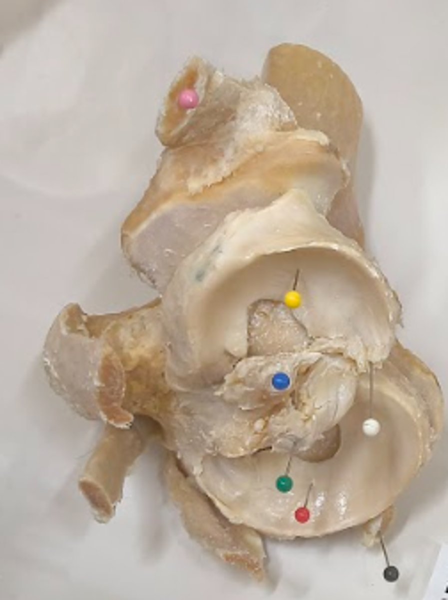 <p>Red pin</p>