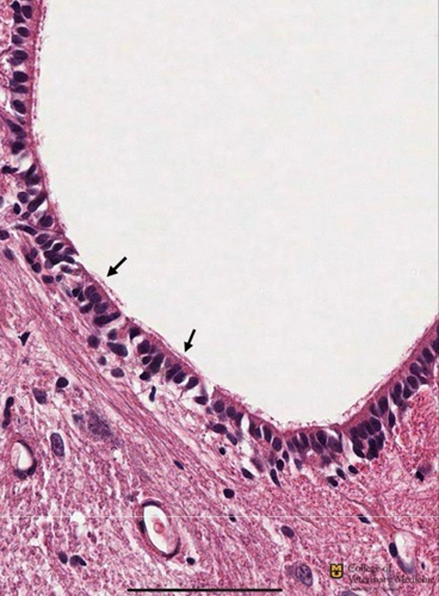 <p>What epithelium type is shown? Note structures black arrows pointing to</p>