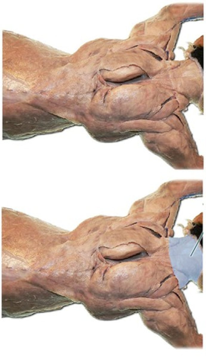 <p>-inserts- on clavicle</p><p>-most anertior of three</p><p>- combined with acrimiotrapezius and spinotrapezius in man</p><p>-arised from back of head and mid dorsal line of neck</p><p>-function: draws clavicle dorsally and toward head (cranially)</p>