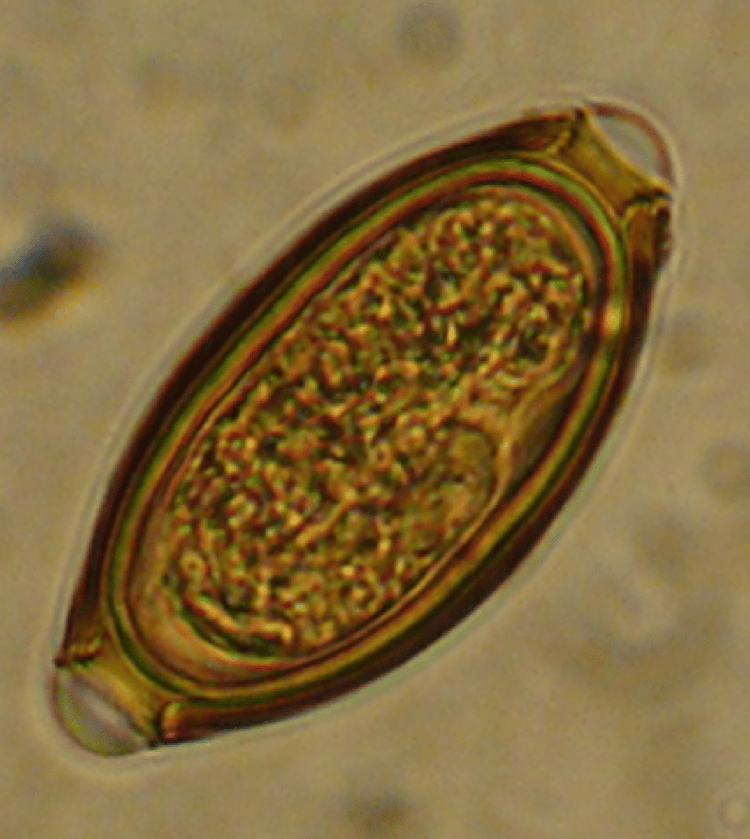 <p>Found in a pig with severe bloody diarrhoea and anaemia. What parasite species does this egg belong to?</p>
