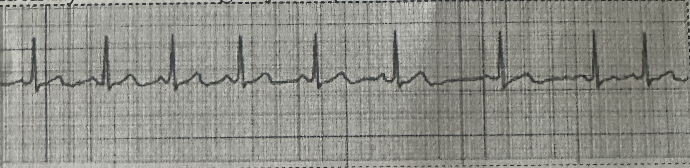 <p>identify this rhythm</p>