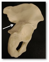 Name this specific part of the pelvic bone.