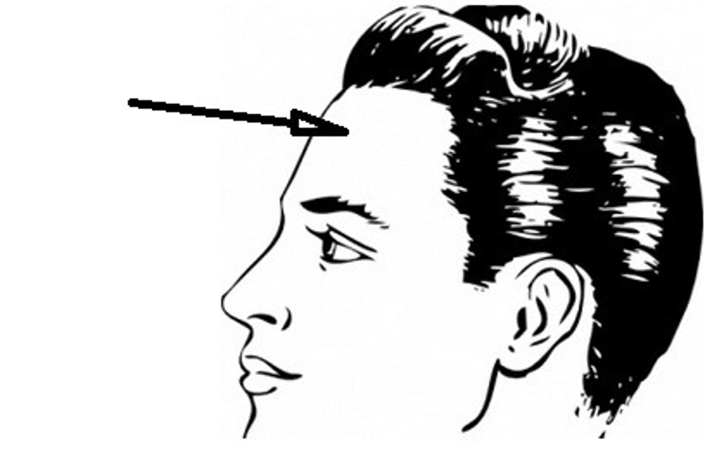 <p>forehead</p>