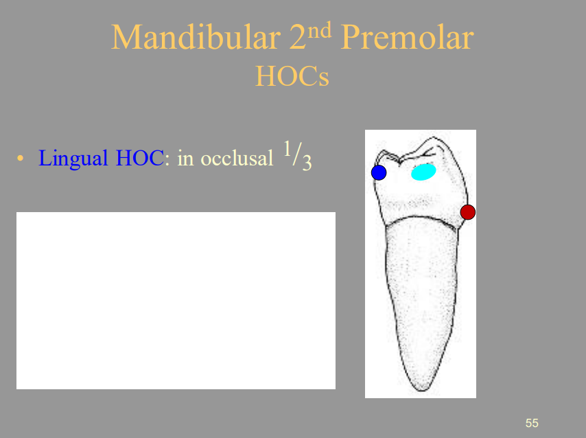 <p>B) Occlusal 1/3</p>