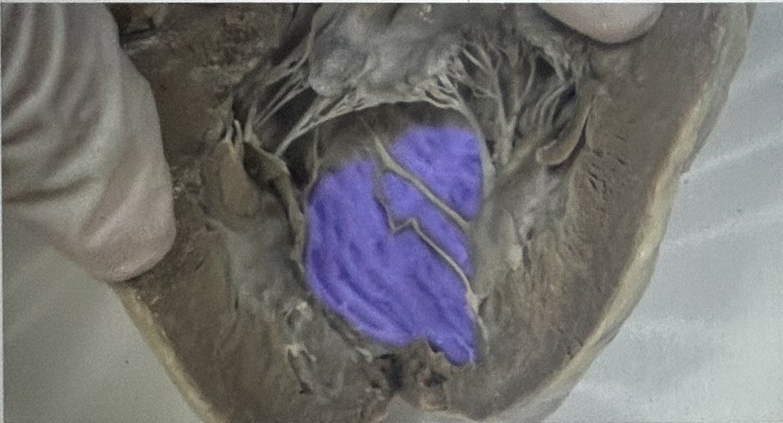 Identify the highlighted sheep heart structure 