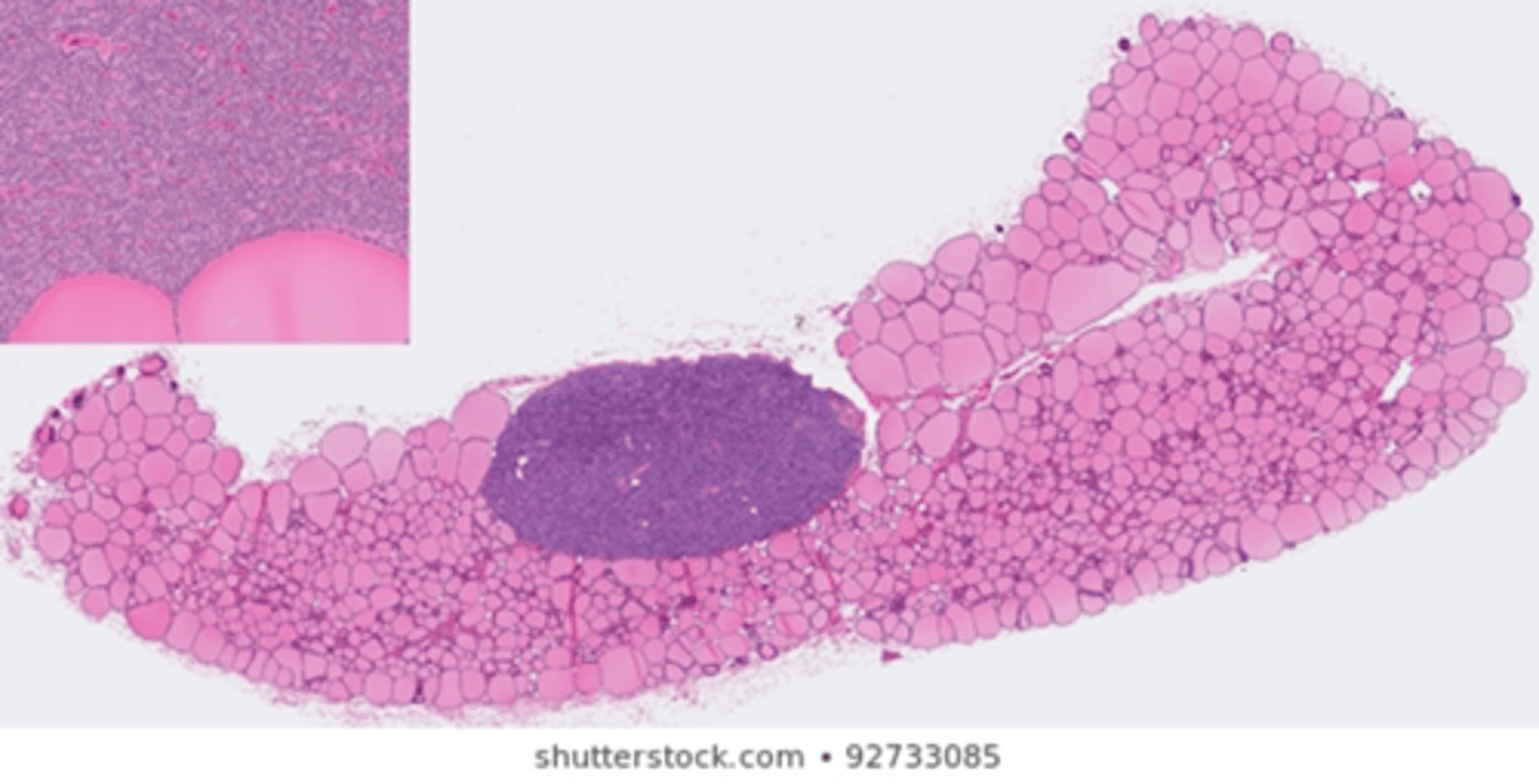 <p>- upfront cost vs ongoing treatment<br>- damage to parathyroid gland —> <em>can induce hypocalcaemia </em></p>