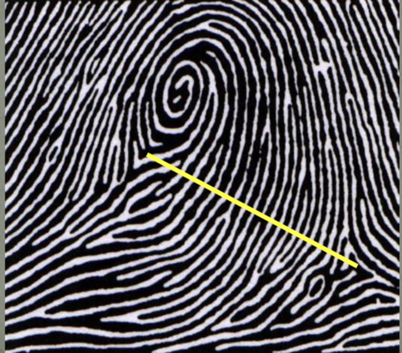 <p>Line between deltas does not cross circular part of ridge pattern</p>