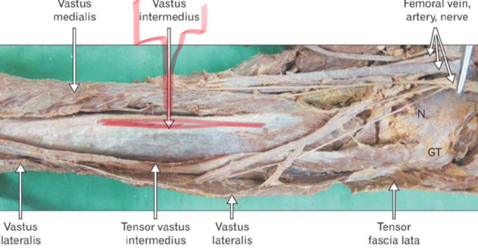 <p>Origin: Anterior and Lateral diaphysis if femur</p><p>Insertion:Tibial tuberosity</p><p>Action: Extend knee</p>