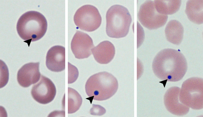 <ul><li><p>remnants of <strong>DNA </strong>that look like a dark purple dot inside cells</p></li><li><p>can be seen in postsplenectomy patients when responding to anemic conditions (erythropoiesis is rushed, no spleen = no removal of abnormal cells)</p></li></ul><p></p>