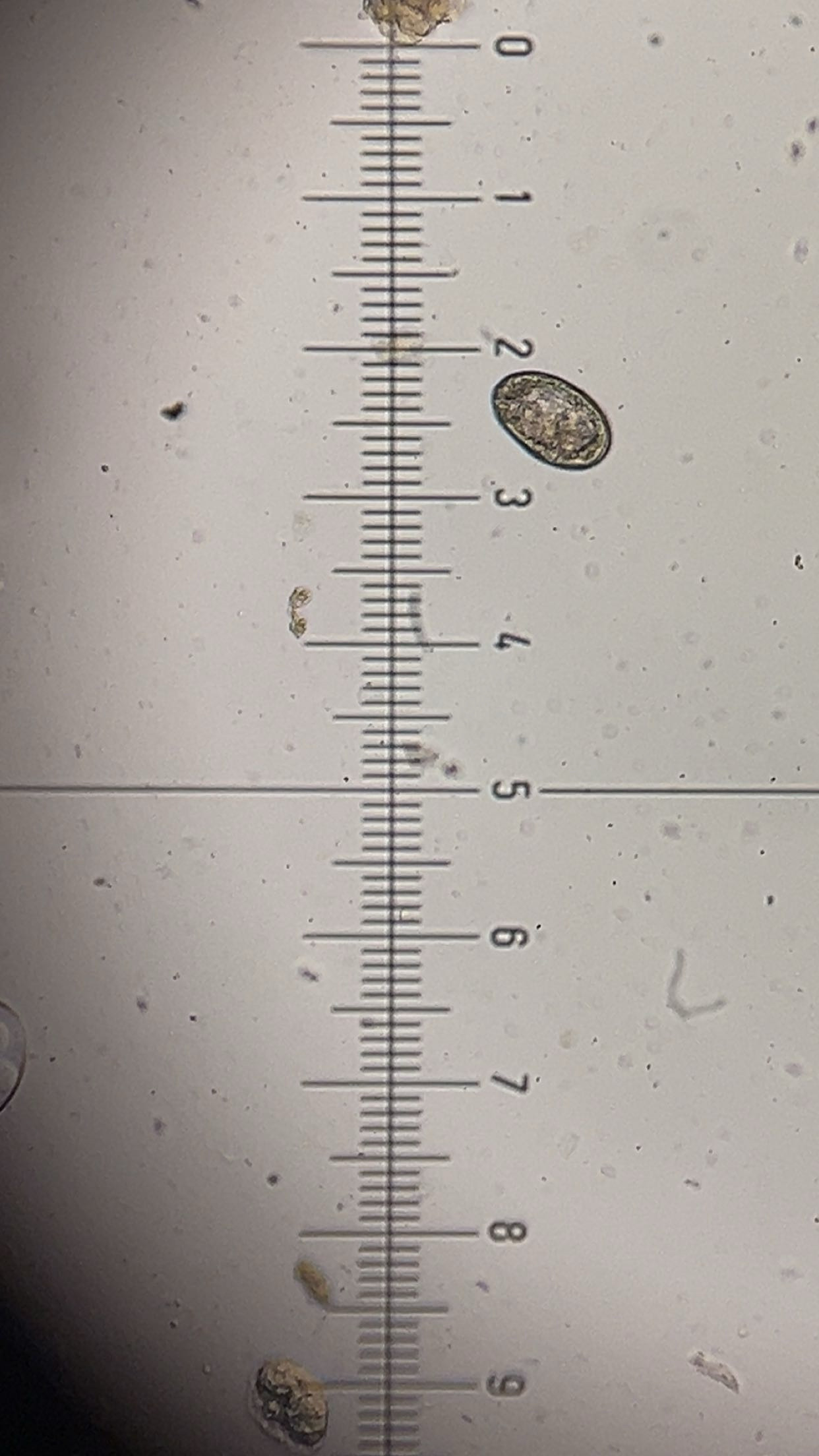 <p><em>Schistosoma japonicum </em>egg</p>
