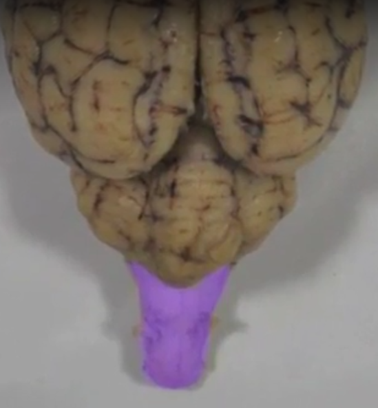 what part of the brain is this?