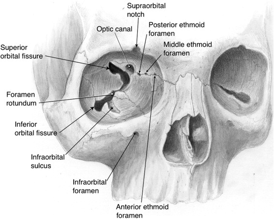 <p>Hapje në murin medial të orbitës.</p>