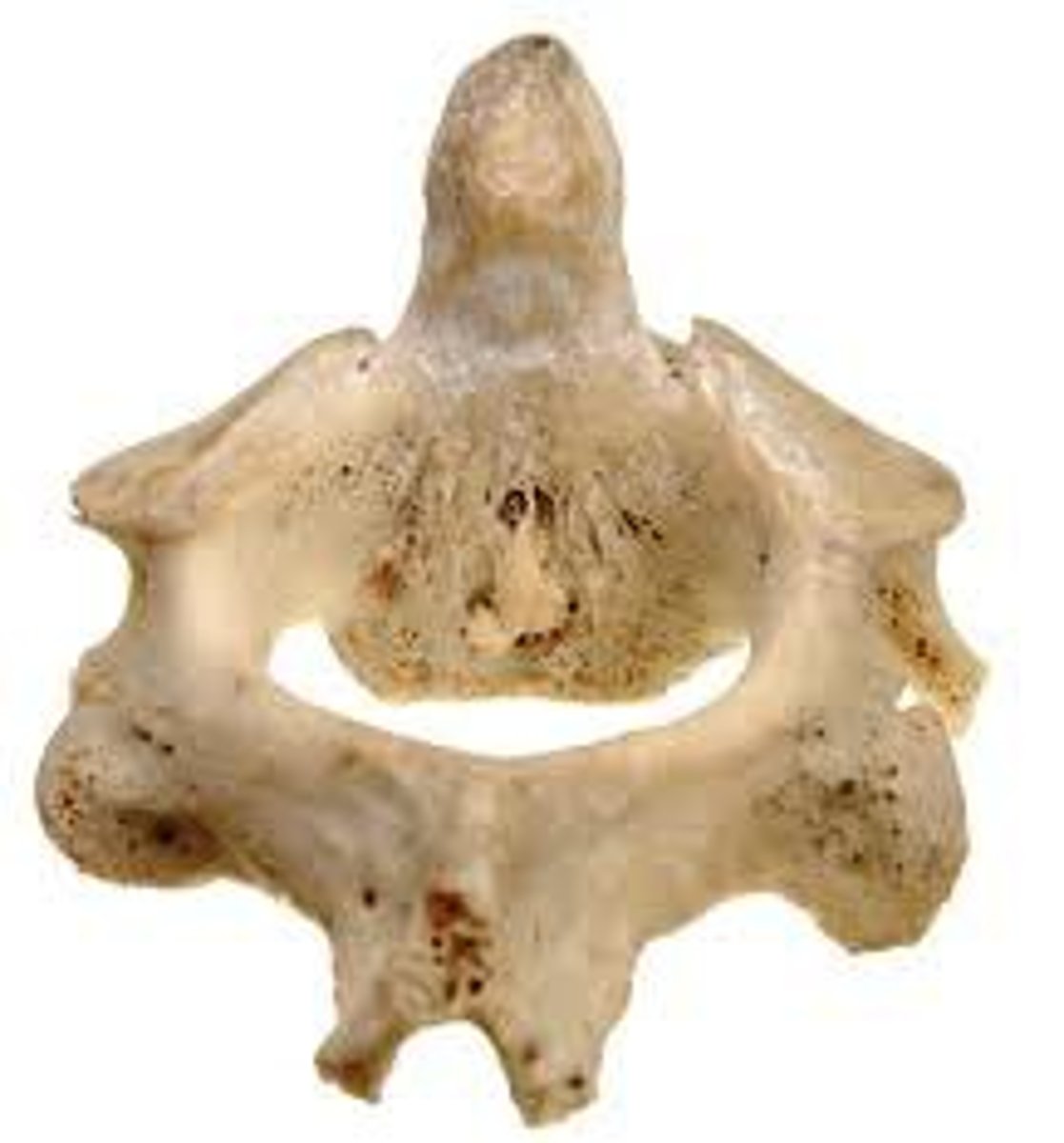 <p>Name the bone.</p>