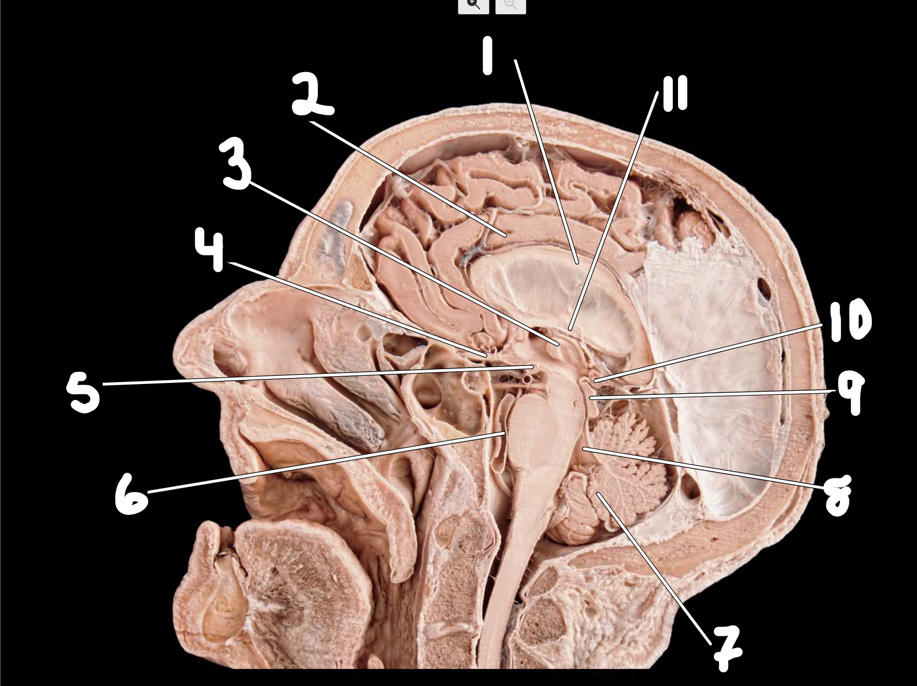 <p>Midsagittal head </p>