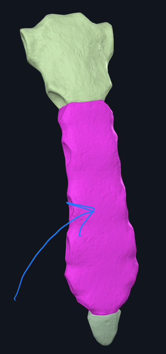 <p>What is this?</p>