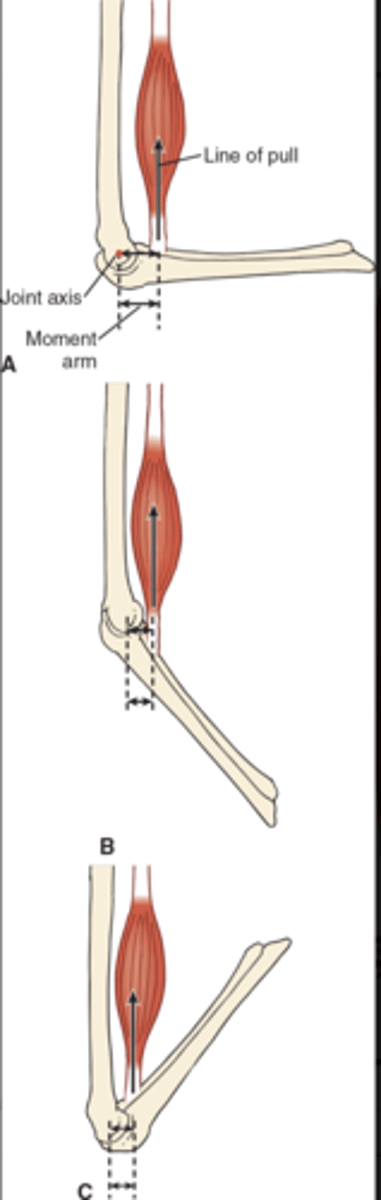 <p>(A) Moment arm and angular force are greatest at 90 degrees. </p><p>(B) As joint moves toward 0 degrees, moment arm decreases and compression force increases.</p><p>(C) As joint moves beyond 90 degrees and toward 180 degrees, moment arm decreases and traction force increases.</p>