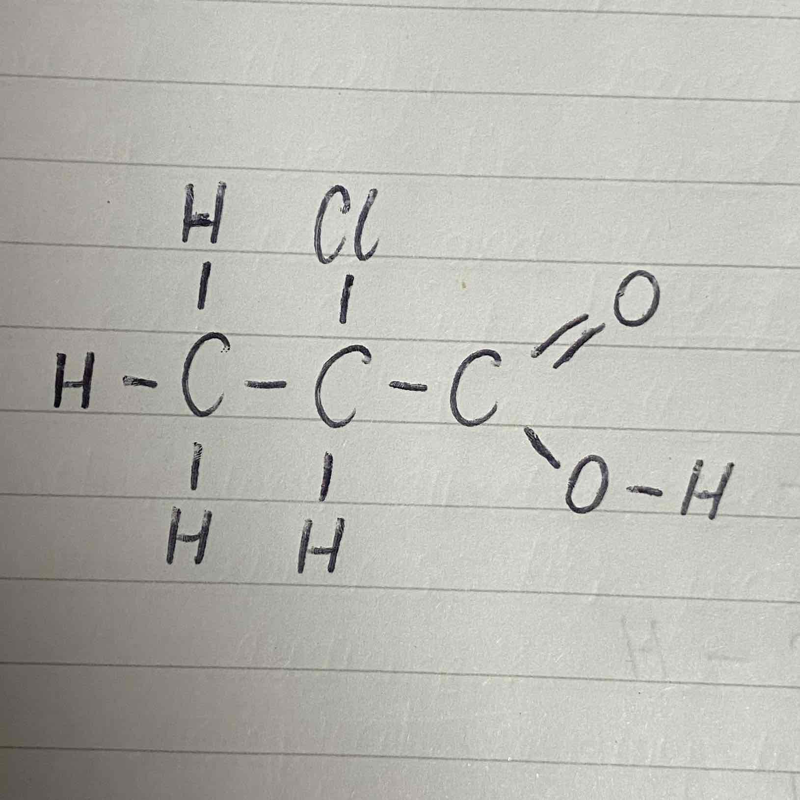 <p>What would be the name of this carboxylic acid?</p>