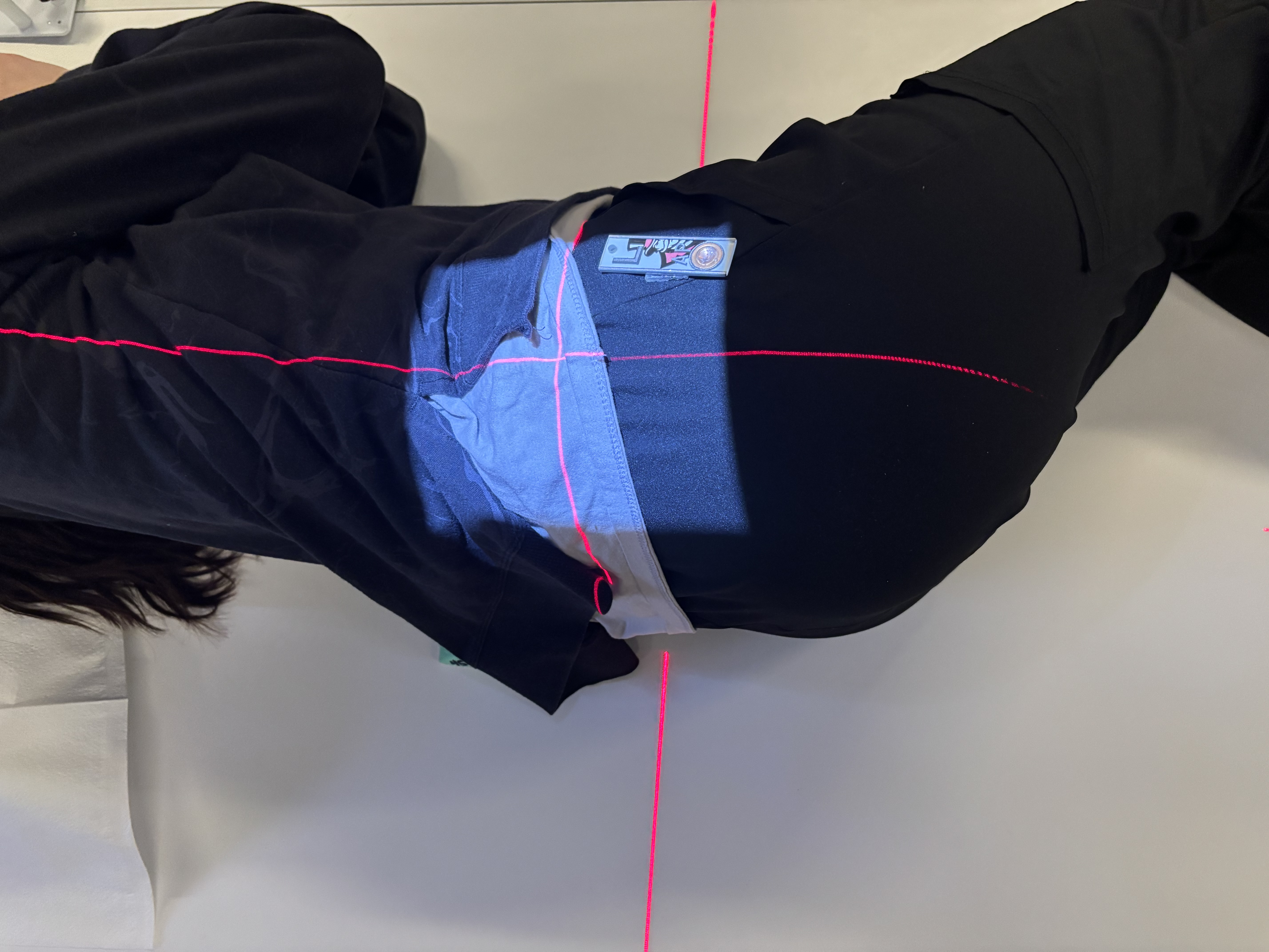 <p>Lumbar- lateral L5 S1 spot</p>