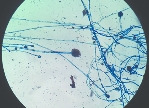 <p>Network of tiny connected filaments that allow fungi to branch out and collect nutrients</p>