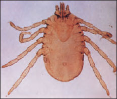 <p><span>Responsible for conditions like scabies (Sarcoptes scabiei) and can cause allergic reactions.</span></p>