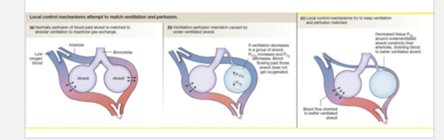 <p>hypoxic vasoconstriction of the pulmonary capillary occurs to re-route blood flow to unblocked alveoli --&gt; V/Q in unblocked region that the blood is shunted to has a initial decrease of V/Q (b/c Q increased) --&gt; rise in PaCO2 + drop in PaO2 (more blood than air in the region) --&gt; chemoreceptors stimulate increased ventilation --&gt; V/Q returns to normal (&amp; so does partial pressures)</p>