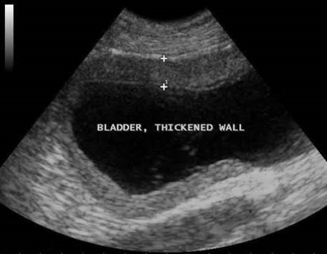 <ul><li><p>bladder wall should be smooth and uniform </p></li><li><p>routinely used to collect urine sample via cystocentesis</p></li><li><p>Function:</p></li></ul><p>- collect, store, and release urine</p><p></p>