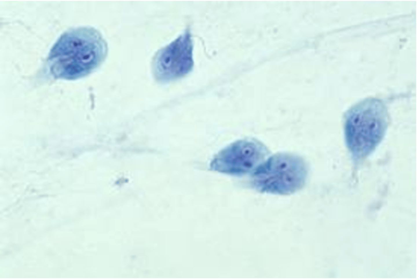 <p>looks like tear drop or balloon with two sucking discs</p>