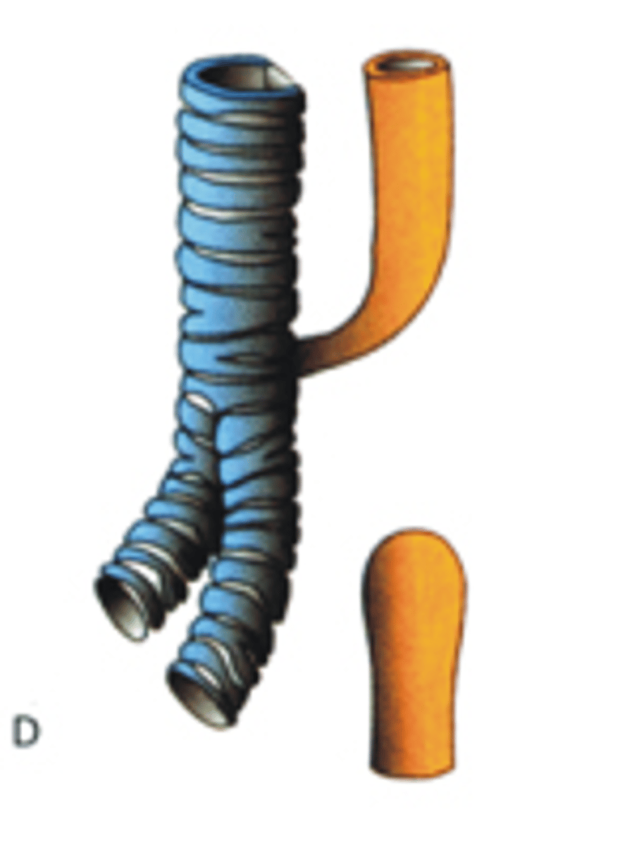 <p>Hoe heet dit type anomalie thv de slokdarm?</p>