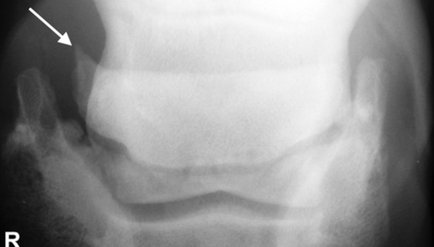 <p>Identify the pathology?</p>