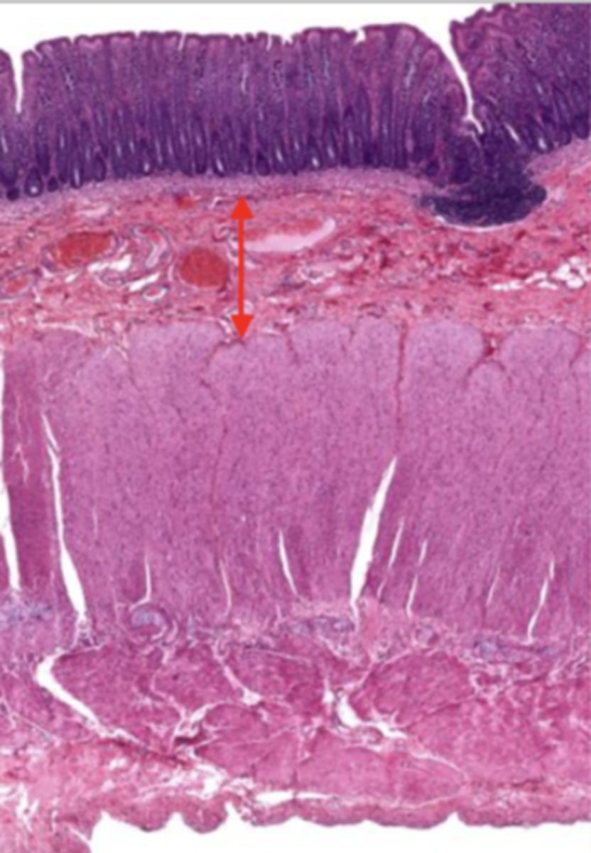 <p>contains glands and blood supply</p>