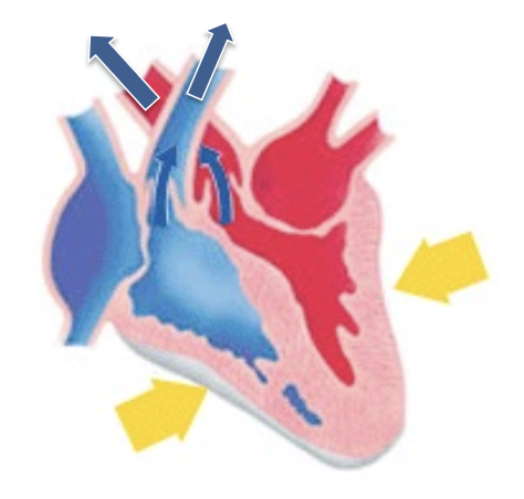 <p>is this systolic or diastolic?</p>