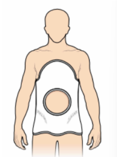 <p>what type of cast is this and indicate the view</p>
