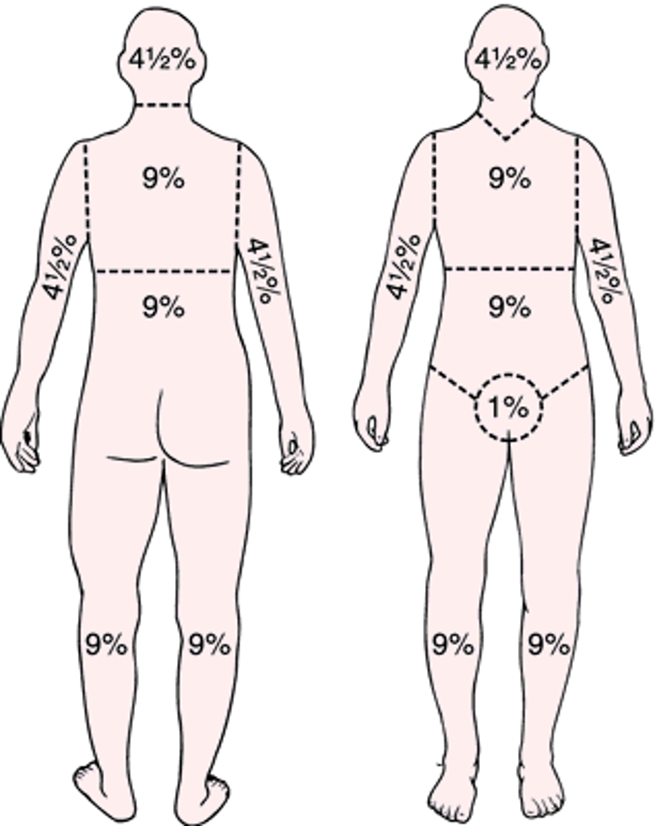 <p>divides the body into 11 sections each accounting for 9%; mainly used to determine the amount of fluids lost in a burn → fastest</p>