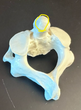 <p>What is this bone and what is circled in yellow?</p>