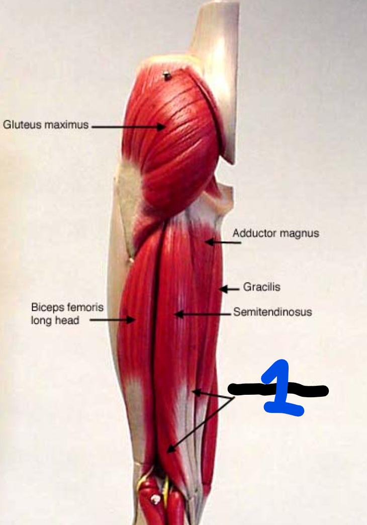 <p><span style="font-family: Arial, sans-serif">What are the 2 actions of this muscle?</span></p>