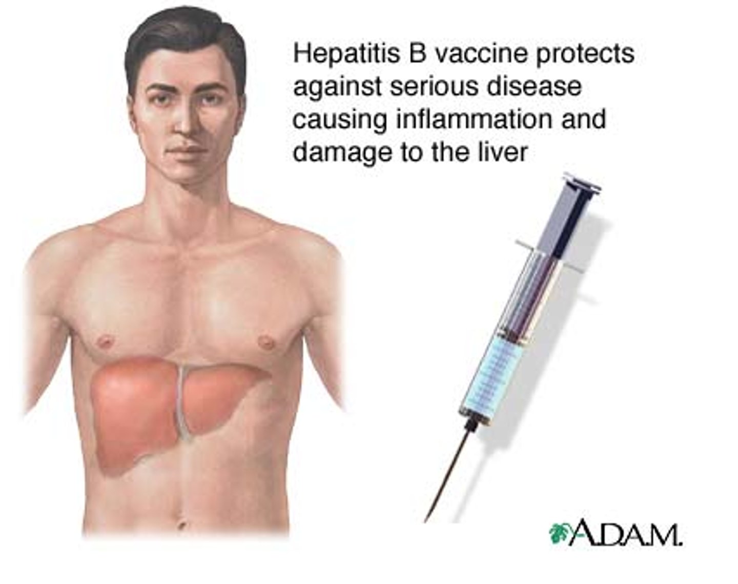 <p>Pathogen: HBV</p><p>Transmission: Unprotected sex, injected drug use</p><p>Prognosis: Serious, can cause chronic hepatitis or induce a carrier state</p><p>Prevention: HBV vaccine</p>