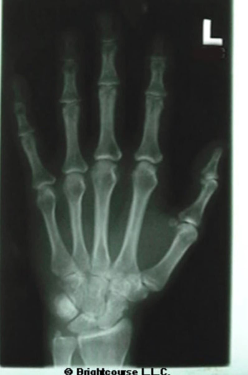 <p>What is name of the radiographic projection?</p>