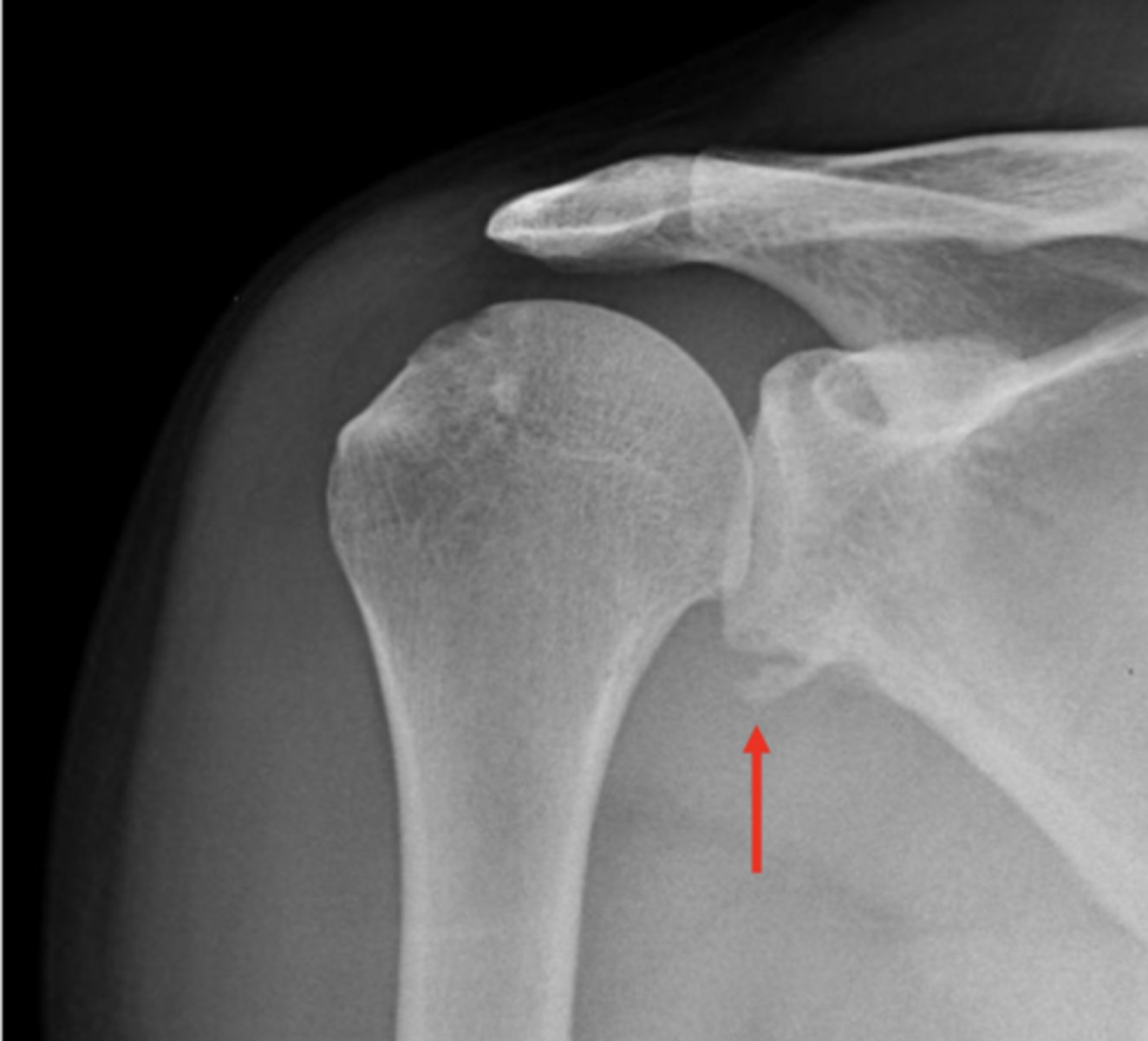 <p>What deformity is seen here</p>