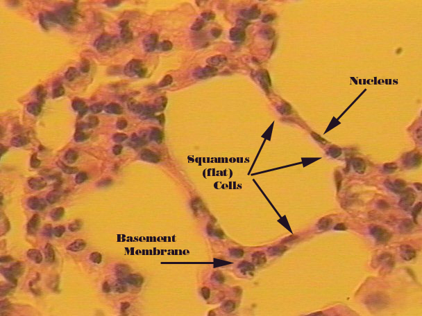 <p>Simple Squamous </p>