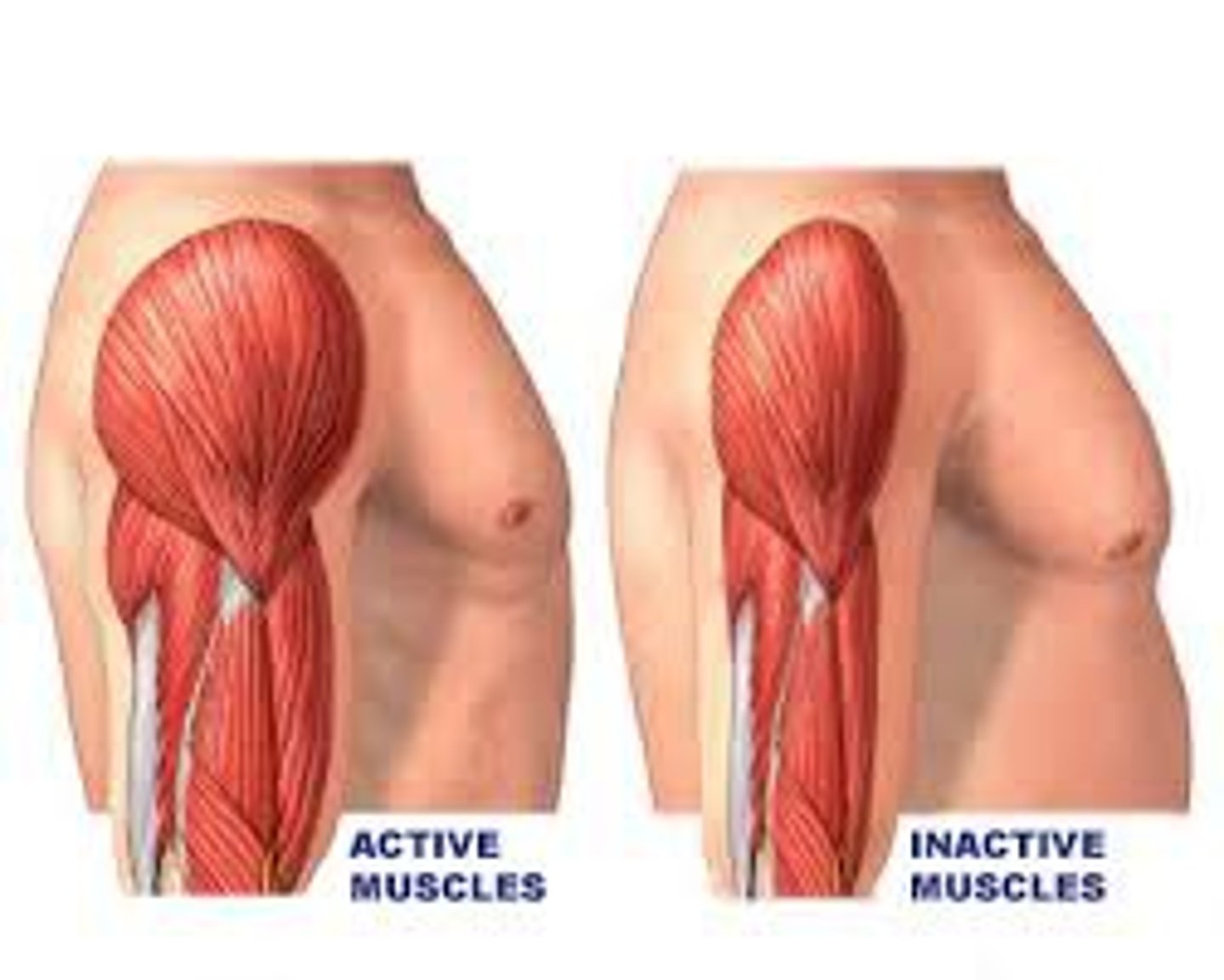 <p>loss of muscle bulk due to muscle disease, nervous system disease, or lack of use; commonly called muscle wasting</p>