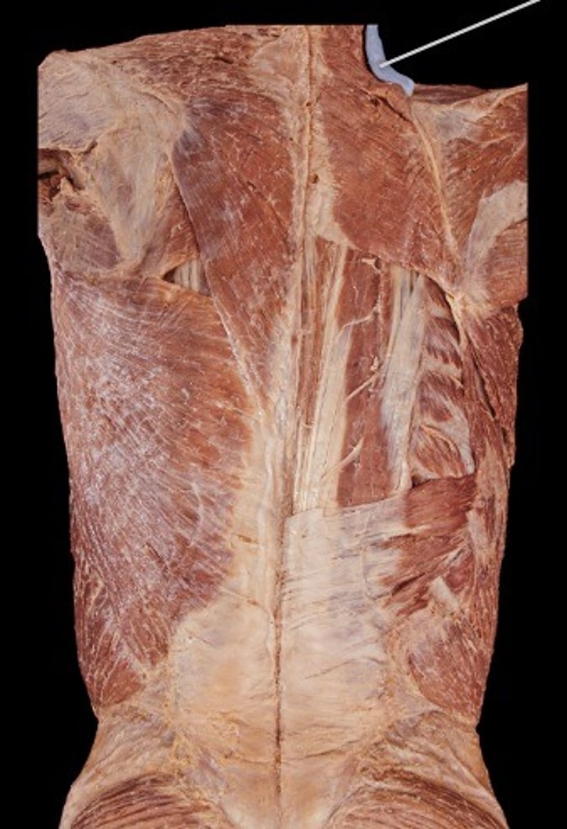 <p>What muscle is this?</p>