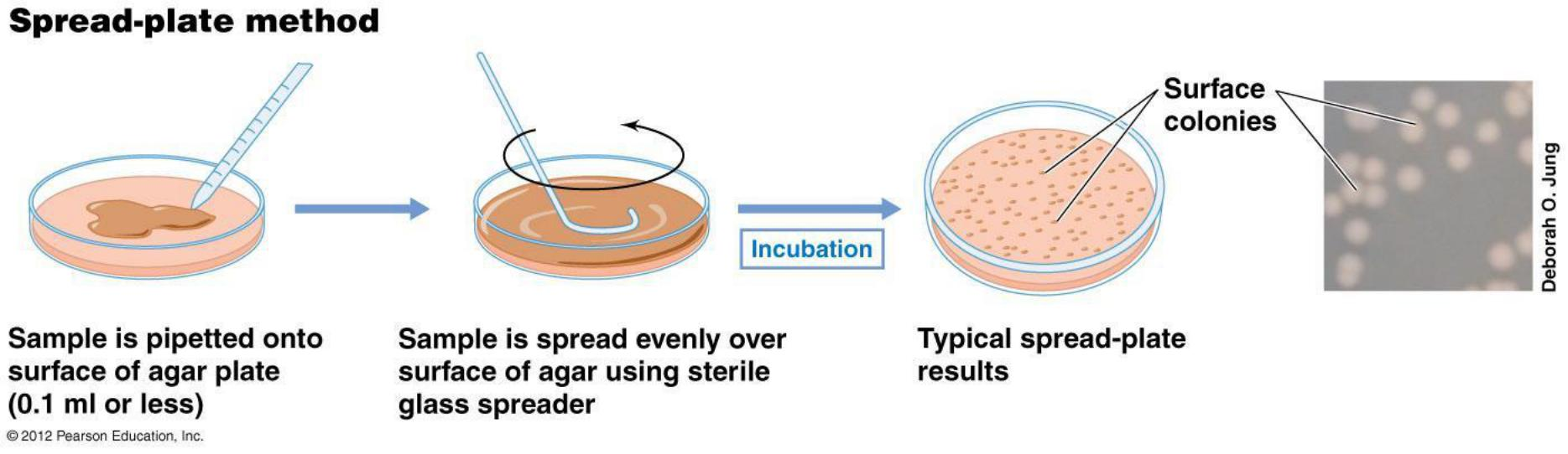 <p>spread and pour plate</p><p></p>